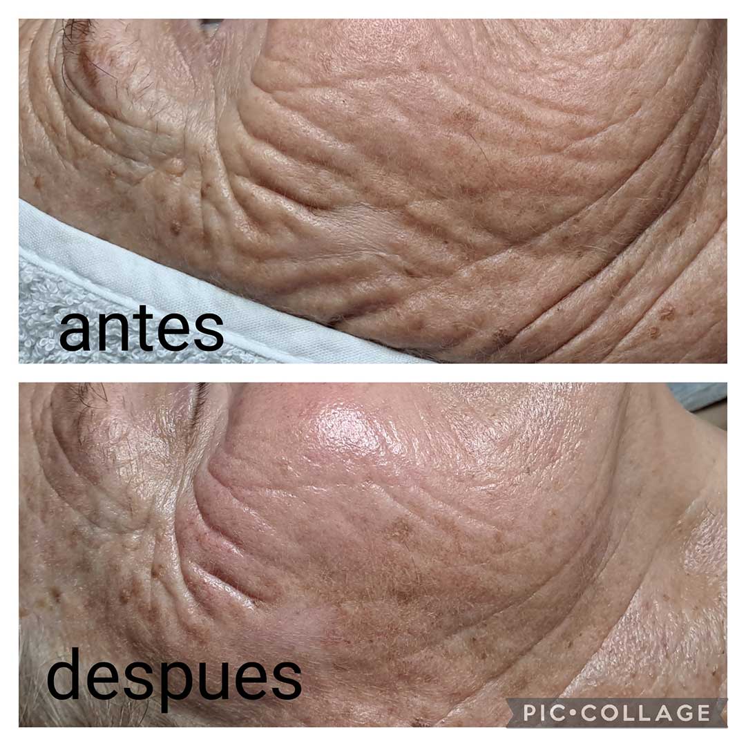 1000022473